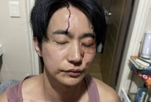 "<b>성병</b> 옮겨" vs. "이별 얘기에 극단적 언행"…폭로전으로 번진 뮤지컬 배...
